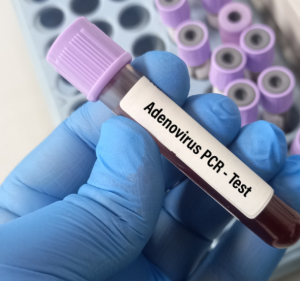 Adénovirus