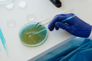 Escherichia coli infection