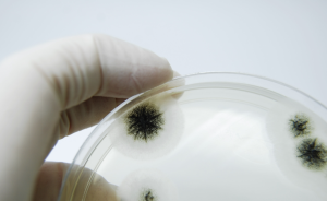 Aspergillus brasiliensis