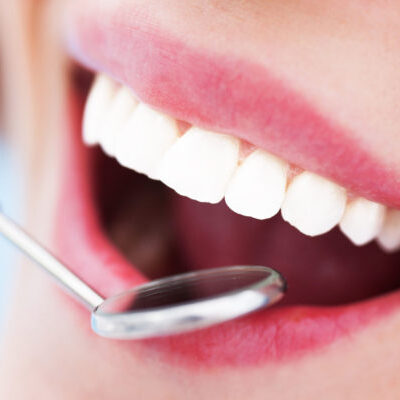 25042471 - woman teeth and a dentist mouth mirror